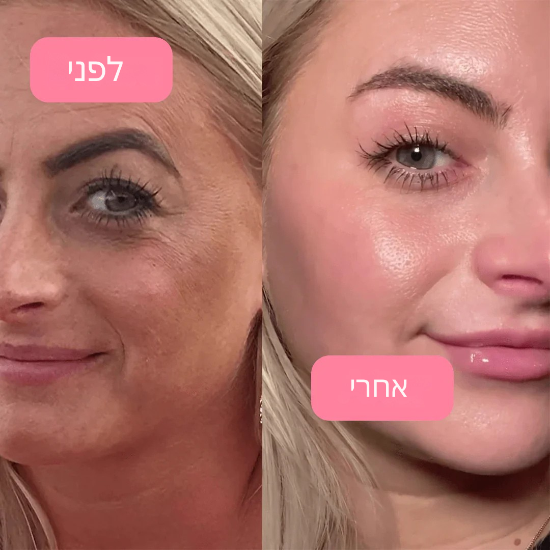 מסכת Glow Up 2.0 – קולגן ולחות אינטנסיבית לעור זוהר