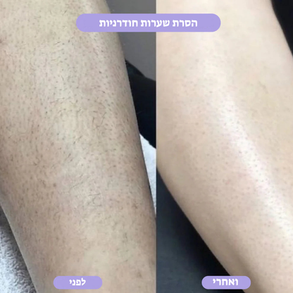 מחק שיער קריסטל – הסרת שיער טבעית, ללא כאבים LAVIN VUITTON