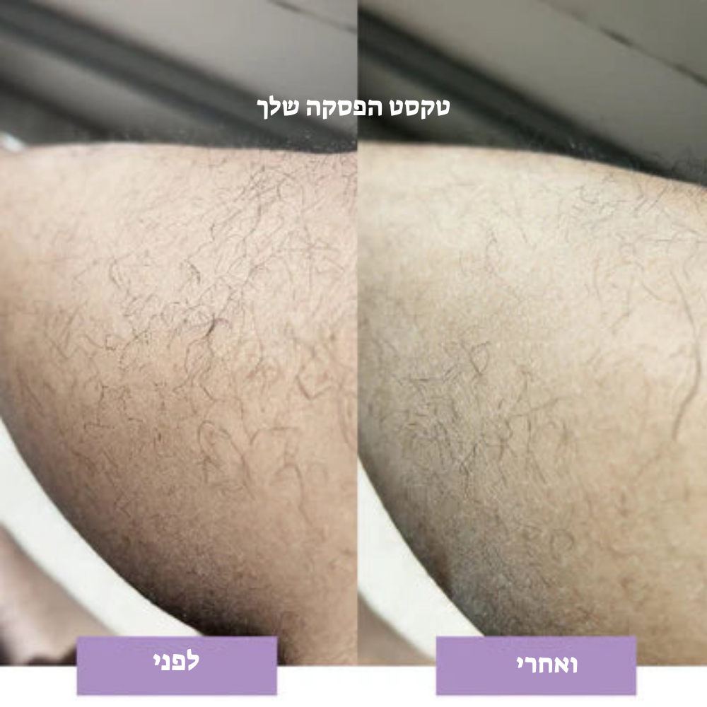 מחק שיער קריסטל – הסרת שיער טבעית, ללא כאבים LAVIN VUITTON