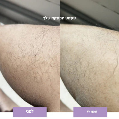 מחק שיער קריסטל – הסרת שיער טבעית, ללא כאבים LAVIN VUITTON