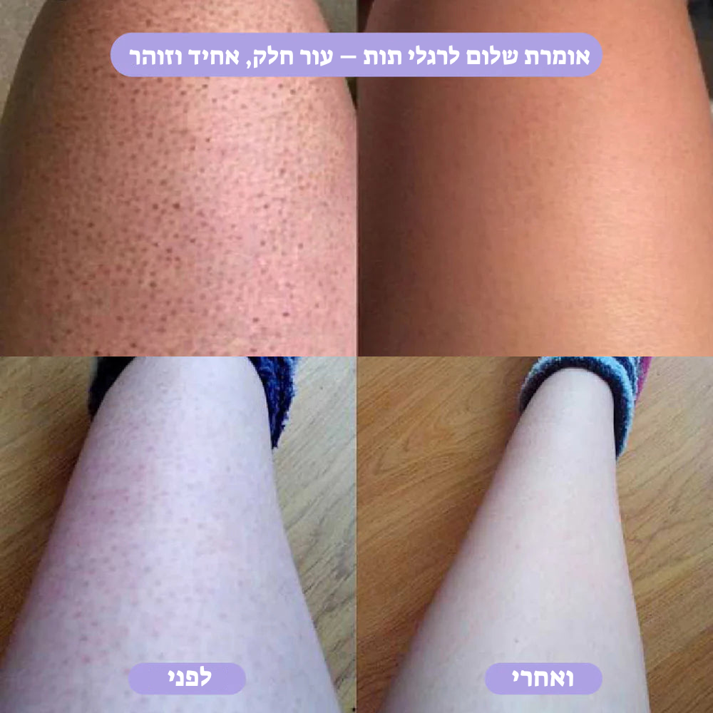 מחק שיער קריסטל – הסרת שיער טבעית, ללא כאבים LAVIN VUITTON