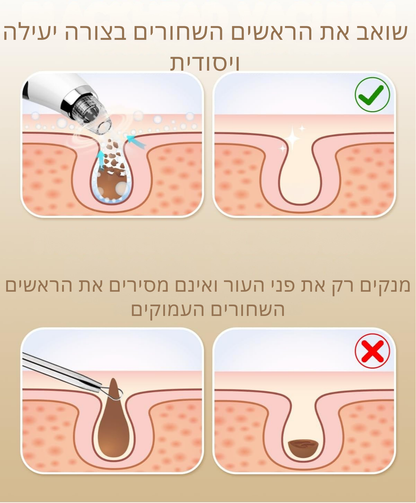 מסיר שחורים חשמלי עם טכנולוגיית וואקום מתקדמת