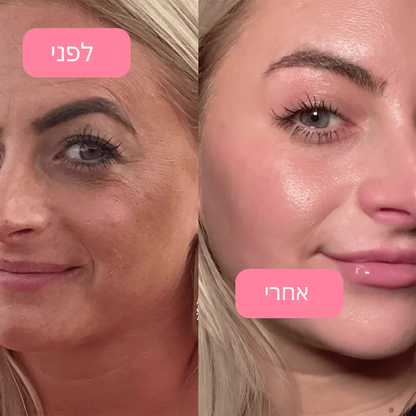 מסכת Glow Up 2.0 – קולגן ולחות אינטנסיבית לעור זוהר