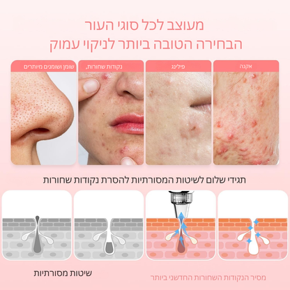 מסיר שחורים חשמלי עם טכנולוגיית וואקום מתקדמת