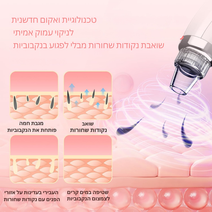 מסיר שחורים חשמלי עם טכנולוגיית וואקום מתקדמת